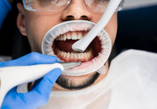 Dental Crowns Procedure