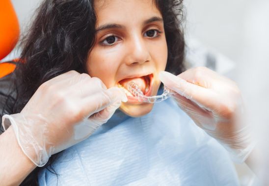 How Invisalign Aligners Work