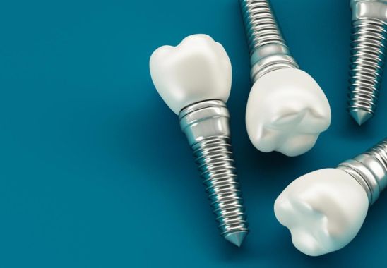 Dental Implant Procedure Explained