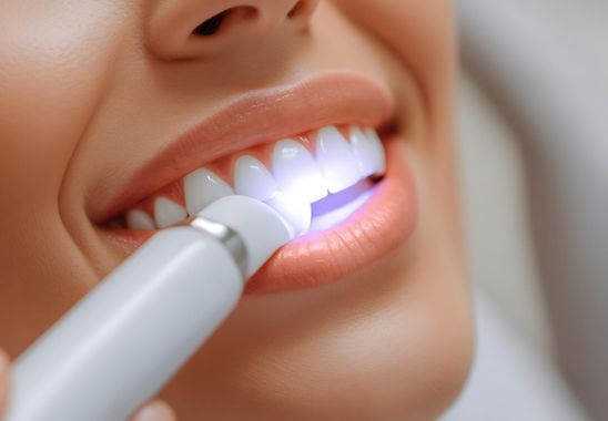 Teeth Whitening Explained
